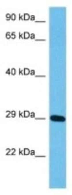 Peflin Rabbit anti-Human, Polyclonal, Novus Biologicals 100 &mu;g; Unconjugated:Antibodies,